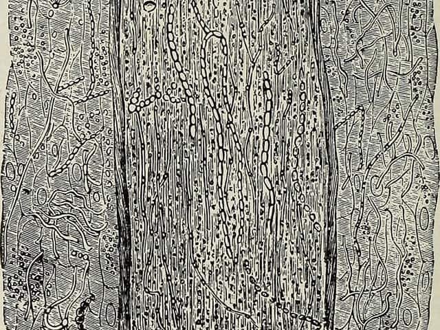غزو داخلي (Endothrix) لساق الشعرة بواسطة فطر *Trichophyton tonsurans*